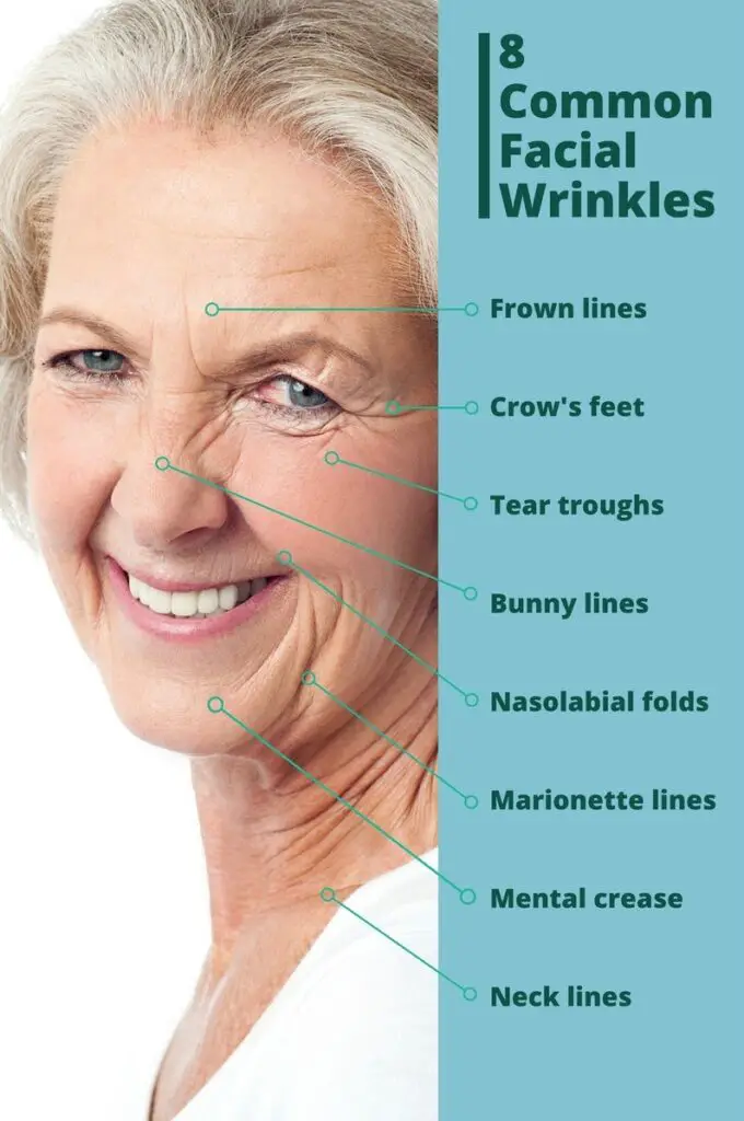 common facial wrinkles