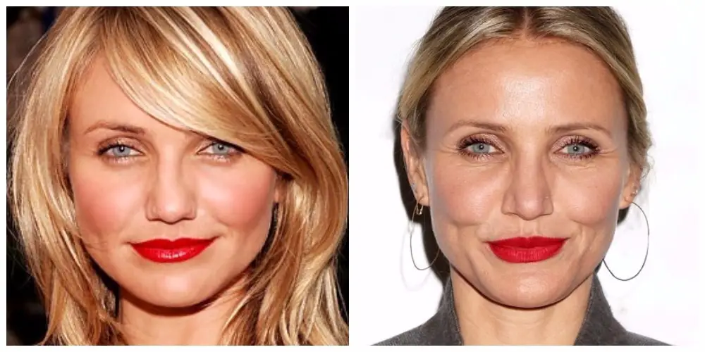 Cameron Diaz, before and after rhinoplasty.