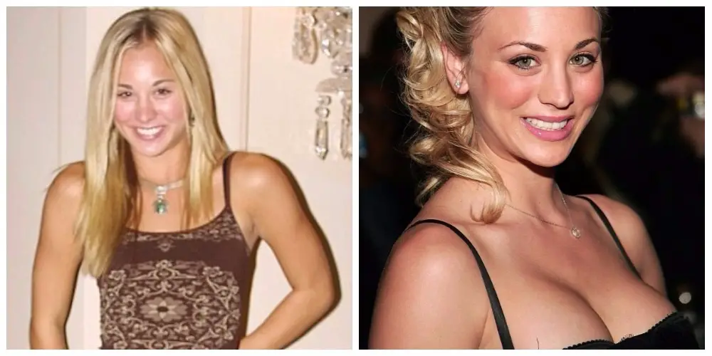Kelly Cuocu, before and after BBT.