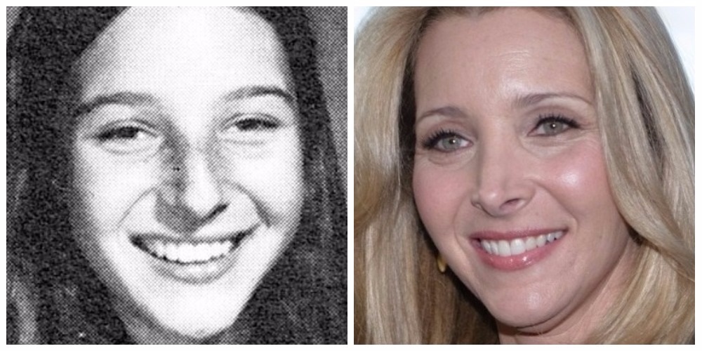 lisa-kudrow-nose-job