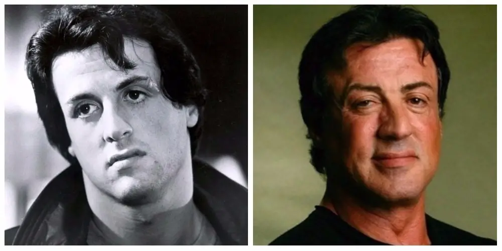stallone before and after